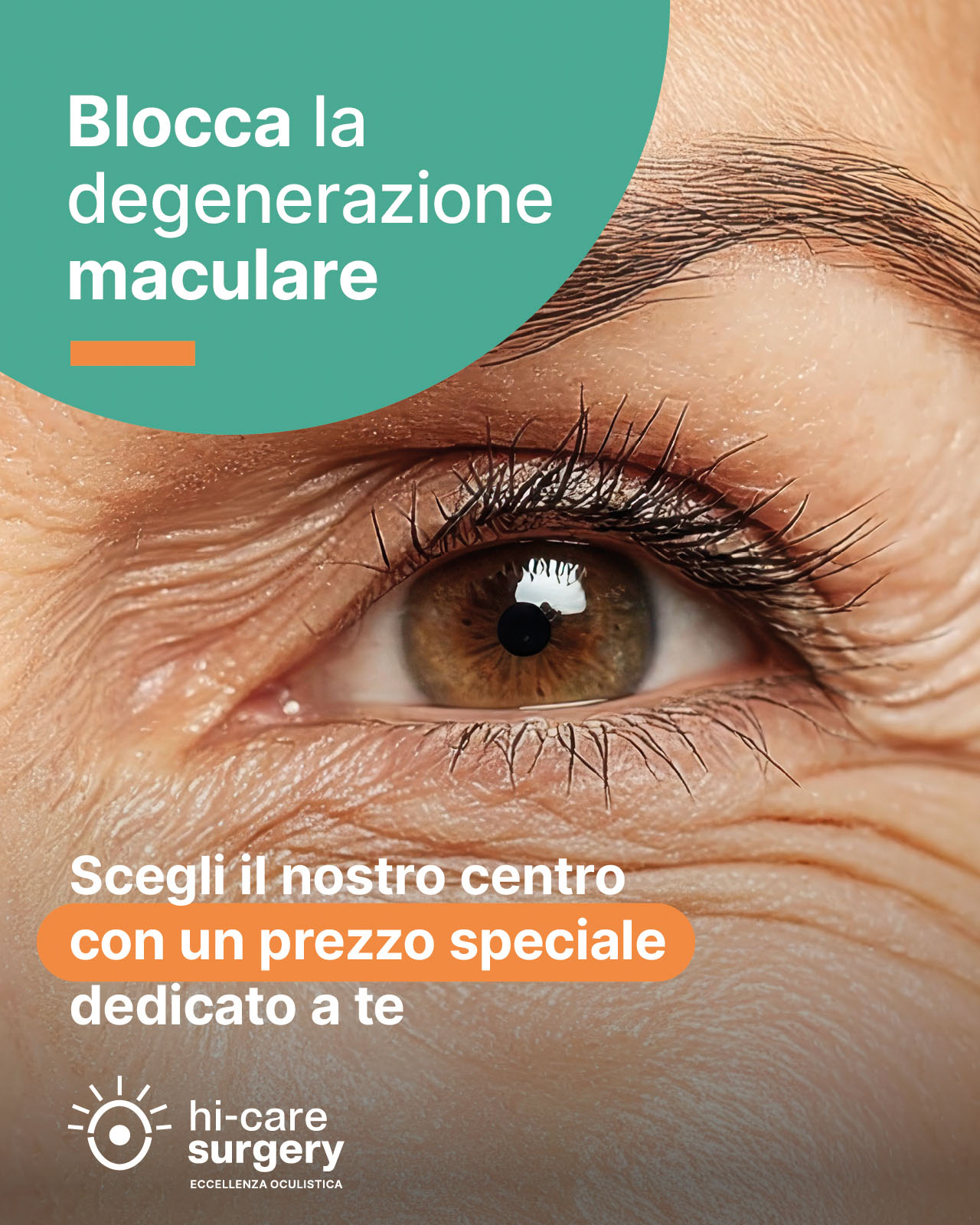 Promo maculopatia hi-care surgery